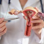 Organ Reproduksi: Mengenali Gejala Infeksi Pemeriksaan Medis